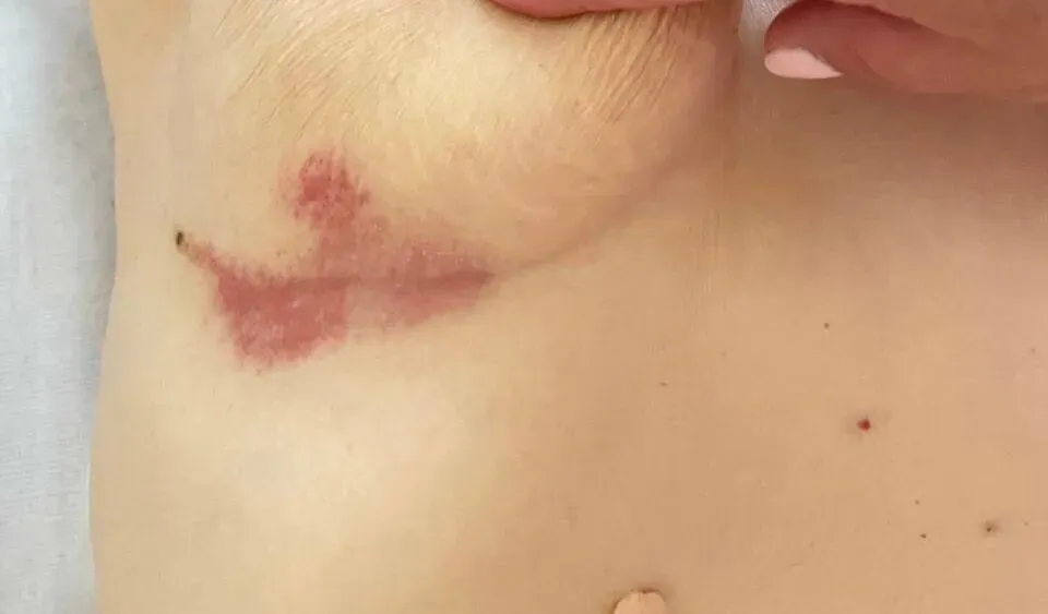 в Воронеже Воронеж - изображение 9